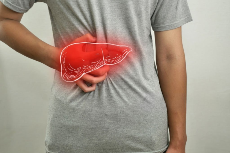 Fatty Liver Symptoms on Face : What Your Skin May Be Telling You